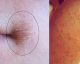 Weird Bumps And Cracked Lips? You Might Be Suffering From This Common Problem