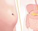 Here Are The 6 Most Common Causes Of Bloating