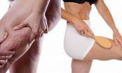 The Real Cause of Cellulite (And How To Get Rid Of It)