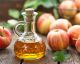 Does Apple Cider Vinegar Really Help You Lose Weight?