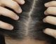 What Makes Our Hair Turn Gray?