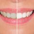 Use Whitening Products