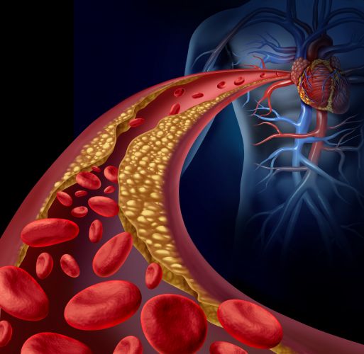 Lower Cholesterol Levels