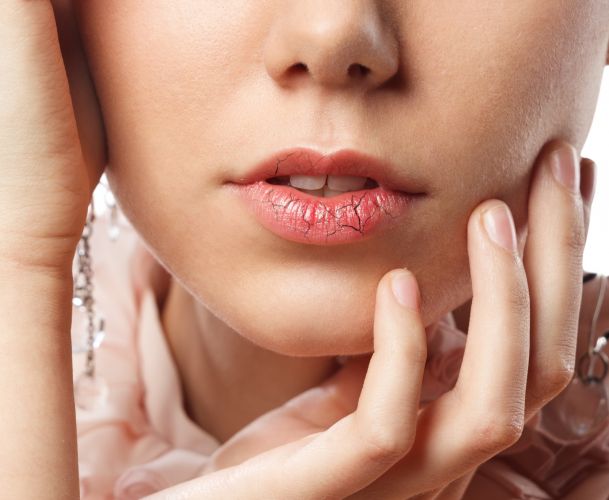 Here's How Your Lip Balm Is Making Your Dry Lips Worse