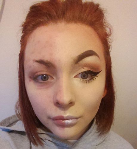 Her Boyfriend Left Her When He Saw What She Really Looked Like