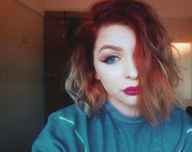 Her Boyfriend Left Her When He Saw What She Really Looked Like