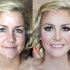 Contouring: before and after