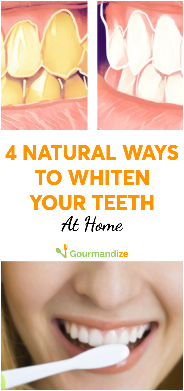 4 Natural Recipes To Whiten Your Teeth At Home